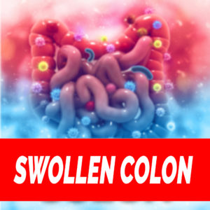 SANE Viscera-3 Swollen Colon & Painful Poop Fix